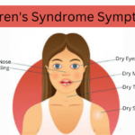 Sjogren’s Syndrome Natural Treatment: Managing Symptoms for a Better Quality of Life